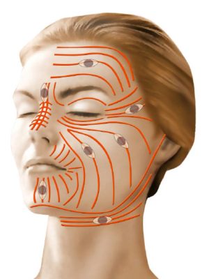 lignes de moindre tension de la face orientation optimale des fuseaux d’excision