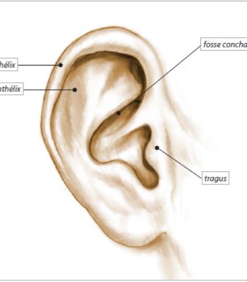 malformations oreilles